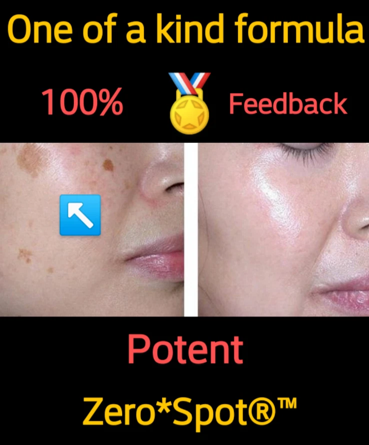 Mancha solar mancha de la edad mancha oscura mancha marrón, removedor, tratamiento/solución - PIEL💙💙 Foto 2 de 4