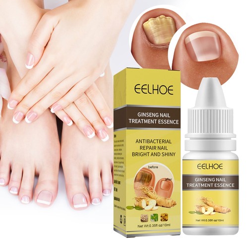 Nail And Toenail Fungus Treatment, Maximum Human Nail Grinders for