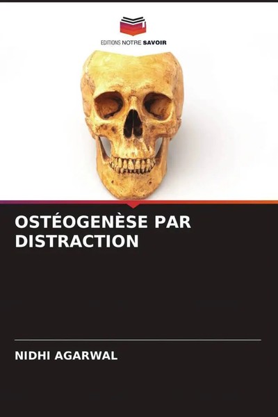 Nidhi Agarwal | OstÉOgenÈSe PAR Distraction | Taschenbuch | FranzöSisch (2022)-image