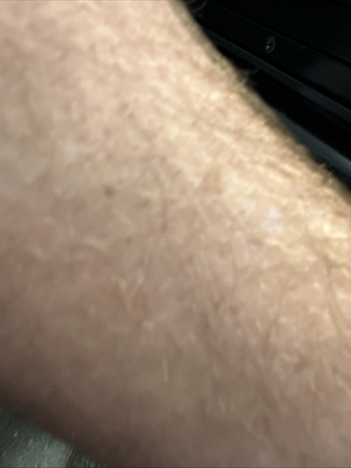 Picture 2 of 3