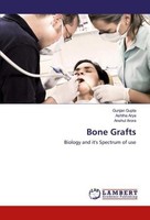 Bone Grafts Ashtha Arya