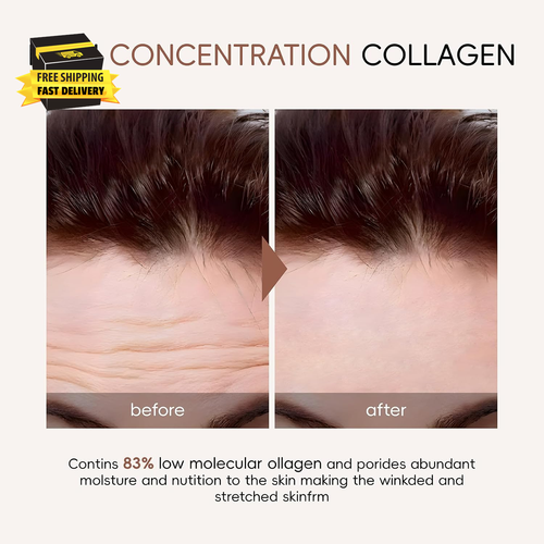 5PC Collagen Mask Overnight, Bio Collagen anti Wrinkle Lifting Mask, Overnight F - Picture 2 of 7