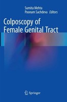 Colposcopy Of Female Genital Tract Sumita Mehta
