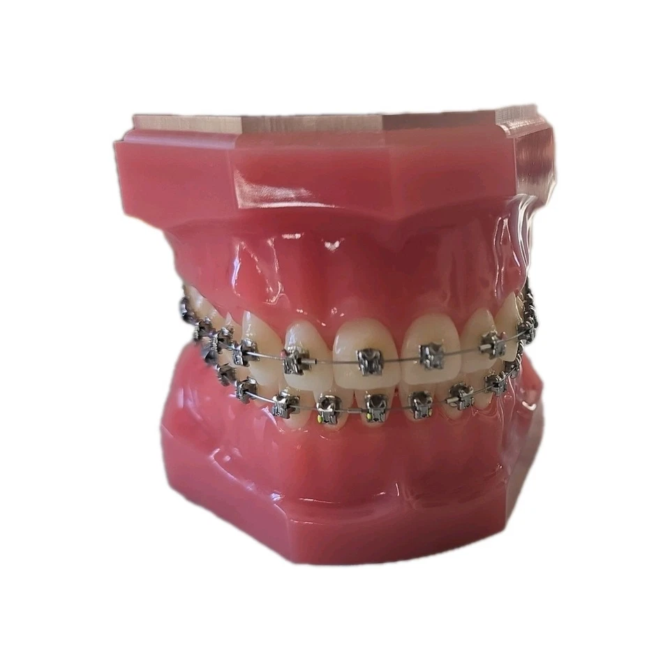 Damon 3MX Consultation Typodont 717-1033 by Ormco - Image 2 of 4