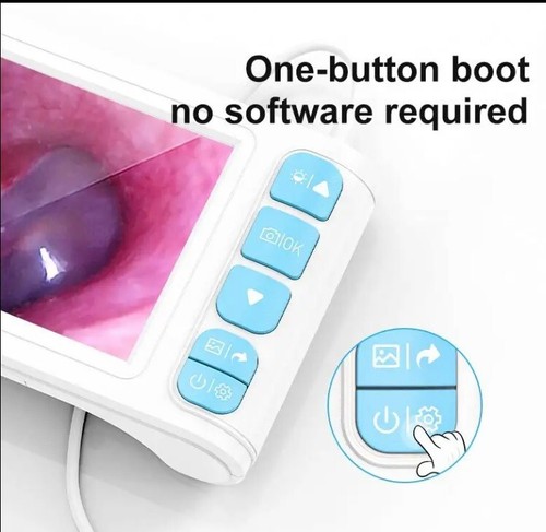 P90 5inch Screen Smart Visual Professional Ear Cleaning Ear Canal Cleaning with - Picture 7 of 8