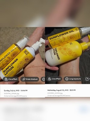 Sct Unlimited Kojic Oil 120ml & 250ml Ultra White Lotion