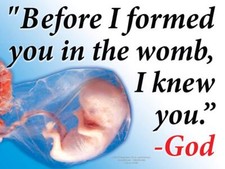 Before I Formed You Pro-Life Yard Sign