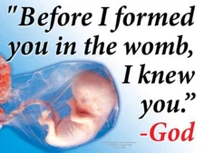 Before I Formed You Pro-Life Yard Sign