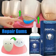 1-20x Dental Cavity Healing Tooth Armor Teeth Care Whitening Enamel Restoration