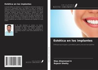 Niaz Ahammed A (U. A.) | EstéTica En Los Implantes | Taschenbuch | Spanisch