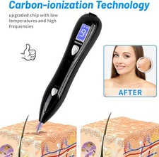 Electric Laser Plasma Pen Mole Remove Dark Spot Skin Wart Tag Tattoo Remove Pen