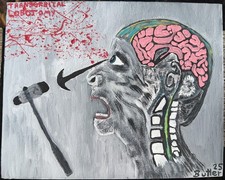 Quadro su tela Lobotomia transorbitale 8x10" firmato dall'artista Leland Butler