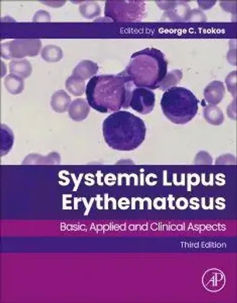 George C. Tsokos | Systemic Lupus Erythematosus | Taschenbuch | Englisch (2026)-image