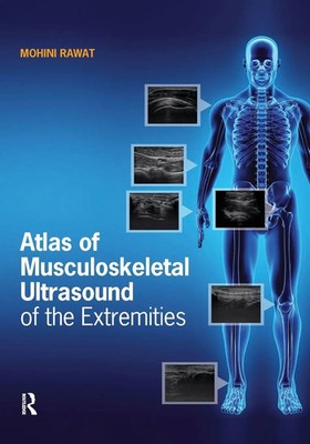 Mohini Rawat | Atlas of Musculoskeletal Ultrasound of the Extremities | Buch
