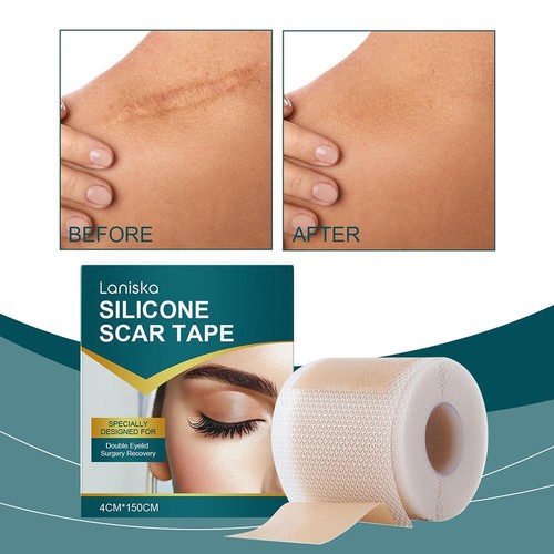 1 * Fogli per cicatrici in silicone, nastro per cicatrici in silicone, fogli di silicone per cicatrici - Foto 3 di 13
