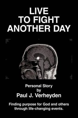 Live to Fight Another Day: Finding Purpose for God and Others Through Life-Chang