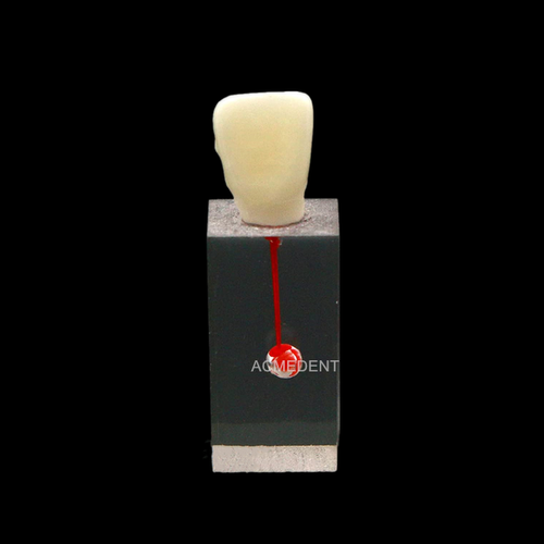 Dental RCT Files Block Endo Rotary File Practice Model Rooth Canal Pulp Crown - Picture 5 of 15