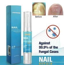 Nail Fungal Treatment Pen Anti Fungus Infection Biological Repairs Solution Care