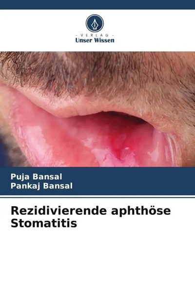 Puja Bansal (U. A.) | Rezidivierende AphthöSe Stomatitis | Taschenbuch | Deutsch-image