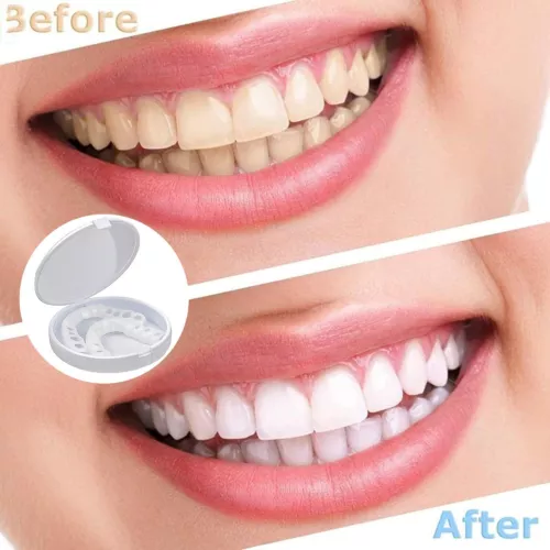 Set superiore e inferiore a scatto denti finti faccette dentali protesi copertura denti US - Foto 4 di 12
