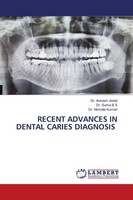 Recent Advances IN Dental Caries Diagnosis Nirmala Kumari