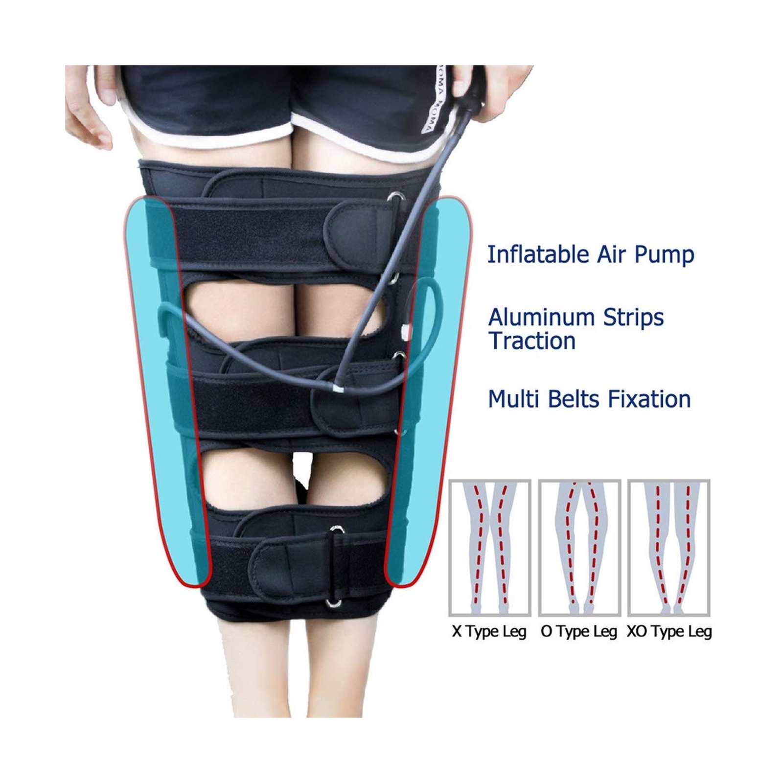 CALIDAKA O/X Leg Type Correction Belt Band Correction Belt Posture Corrector ...