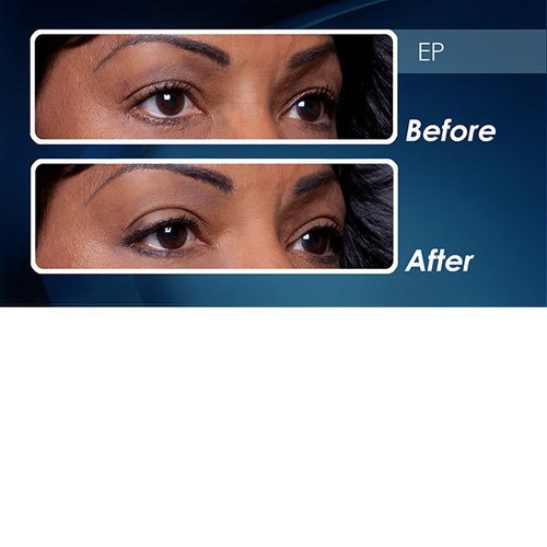 Eye Magic Original Instant Eye Lifting Kit - Bild 6 von 7