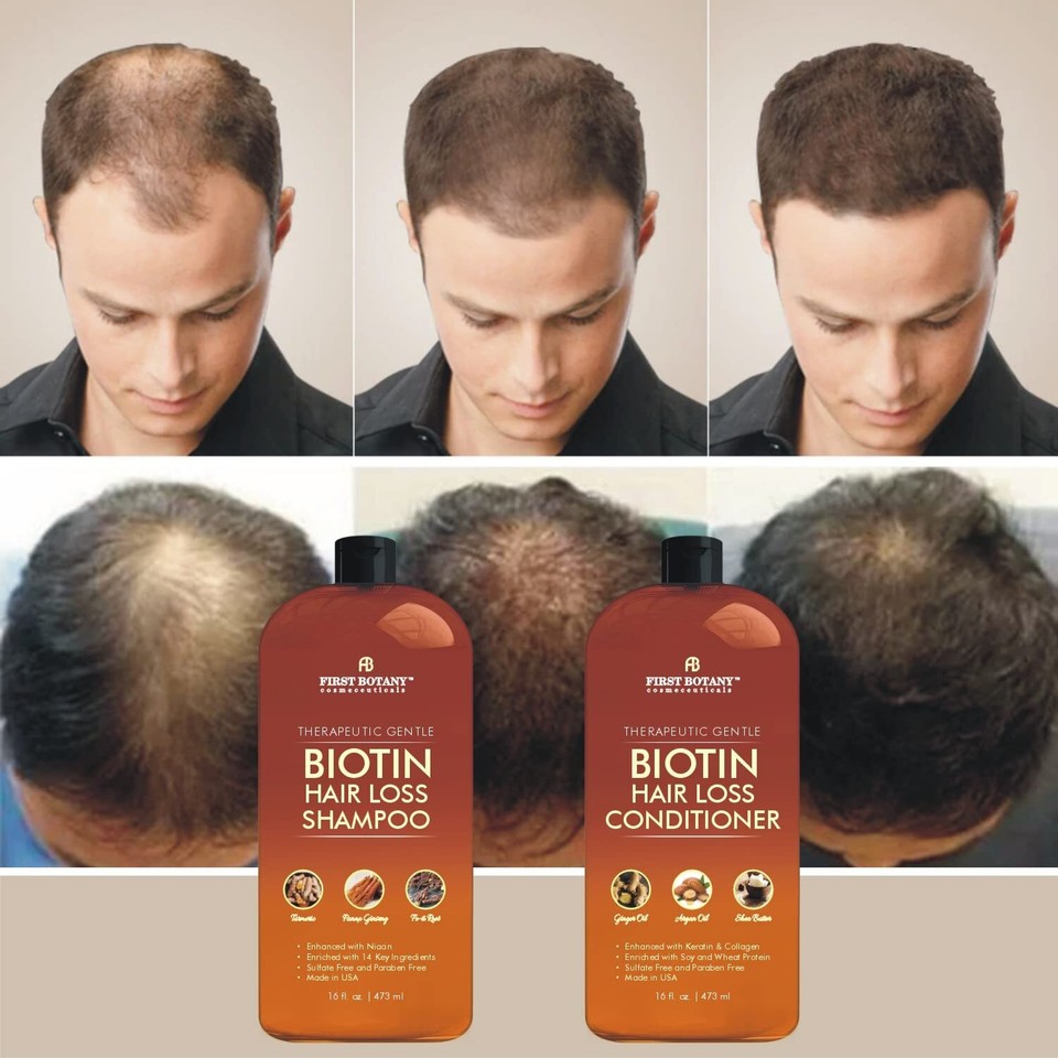 , Hair Growth Shampoo Conditioner Set An Anti Hair Loss Biotin
