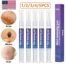12 Hours Wart Remover Pen Skin Tag Mole Remover Eliminate Foot Corn Warts Unisex