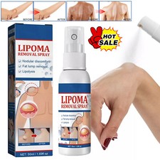 50ML Lipomheilung Reduction Spray, Instant LumpFree Lipoma Removal Spray