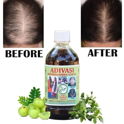 Natural Adivasi Bhringraj Herbal Hair Oil 100ml Made With Pure Ayurvedic Herbs