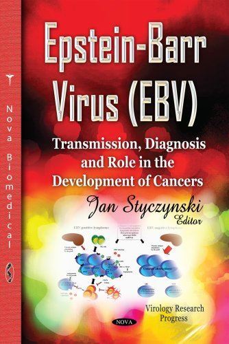 EPSTEIN BARR VIRUS EBV TRANSMISSION: Transmission, Diagnosis and