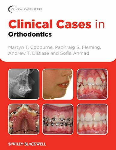 Clinical Cases in Orthodontics (Clinical Cases Uncovered) - Image 5
