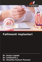 Anuja Lugade (U. A.) | Fallimenti Implantari | Taschenbuch | Italienisch (2024)