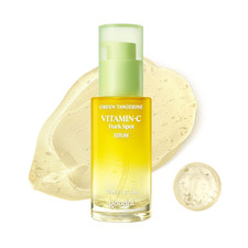 Green Tangerine Vitamin C Serum - Targets Dark Spots  Post-Acne Hyperpigmentati