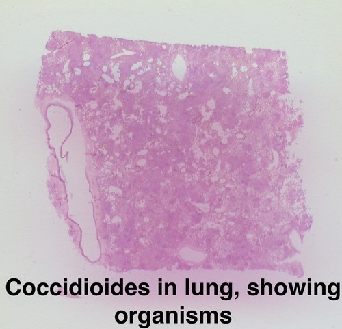 TURTOX Microscope Slide Set HUMAN Histology PATHOLOGY Embryology ORGAN SYSTEMS - Picture 4 of 9