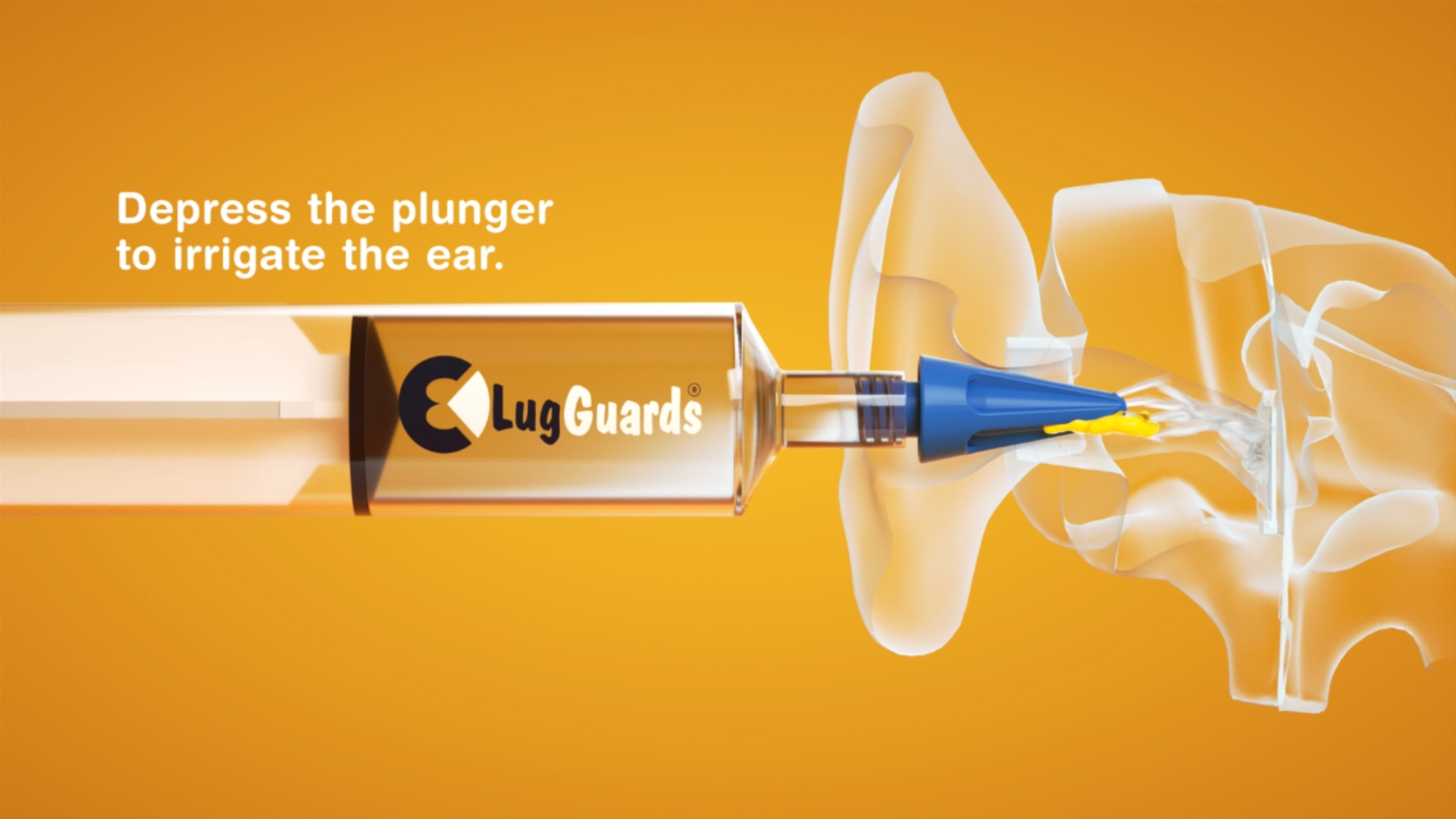 LugGuards Quad Stream Ear Wax Removal Syringe 20ml+4 Colour Coded Tips