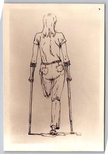 Confident One-Legged Woman on Crutches – Rare 70s Vintage Illustration Photo