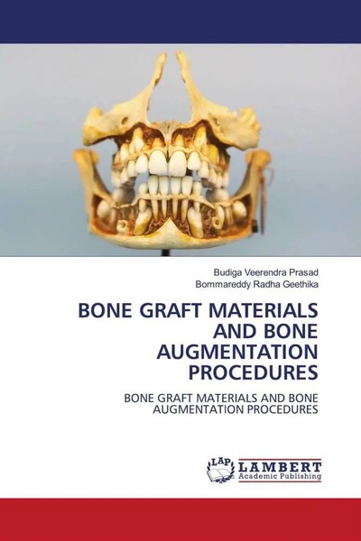 Budiga Veerendra Prasad (U. A.) | Bone Graft Materials AND Bone Augmentation...-image