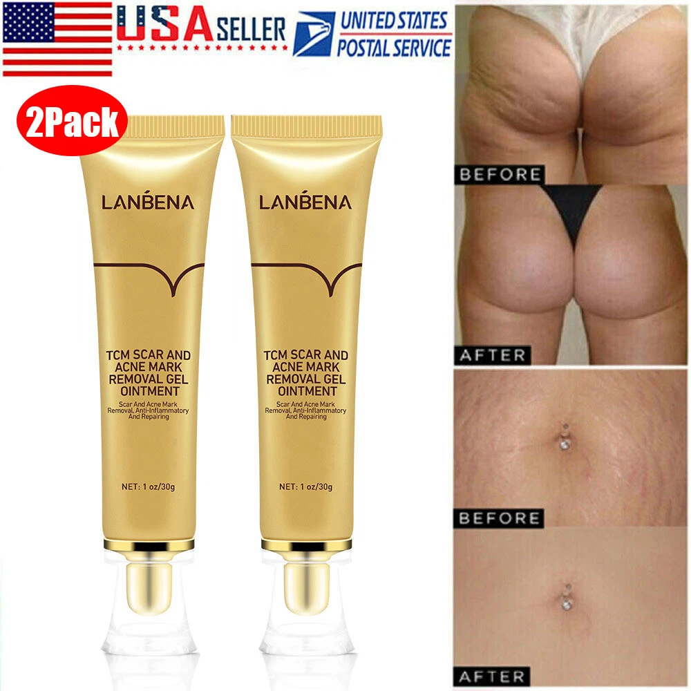 Scar Removal Cream For Old Scars Stretch Mark Spots Gel for Men