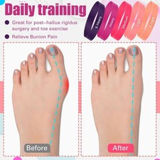 5pcs Hallux Valgus Alignment Foot Stretcher Resistance Loop  Yoga Exercise
