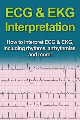 ECG & EKG Interpretation: How to interpret ECG & EKG, including rhythms, arrhyth