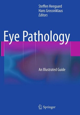Steffen Heegaard (u. a.) | Eye Pathology | Taschenbuch | Englisch (2016) | viii