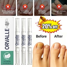 Orville Anti Fungal Pen Intensive Treatment Toenail Fungus Foot Nail Repair Oil
