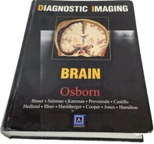 Cancer Brain Radiology Research Book Diagnost...