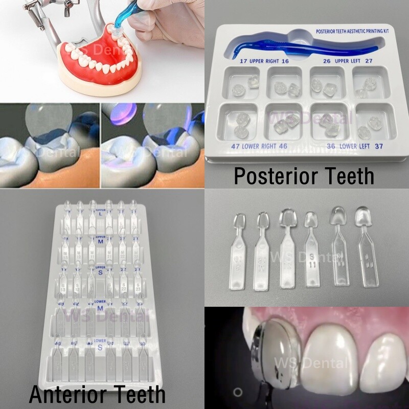 Lote De 160 Molares Posteriores Inferiores De Resina Acrílica Para Laboratorio Dental - Varios Tonos/tamaños
