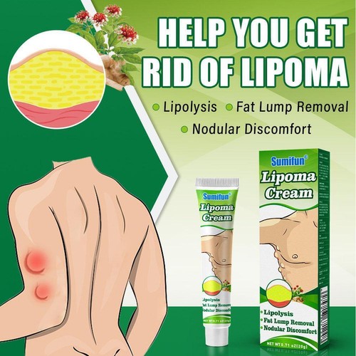 Lipomas Cream Antibacterial Cleansing Cellulite Fat Removal20g Lump -Us- - Picture 5 of 12