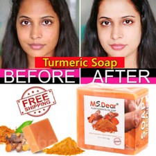 Tumeric Soap, Skin Whitening Dark Spots Lightening Anti Acne Brightening Tighten