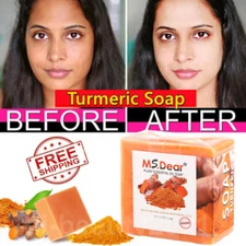 Tumeric Soap, Skin Whitening Dark Spots Lightening Anti Acne Brightening Tighten