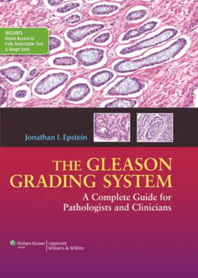 The Gleason Grading System: A Complete Guide for Pathologist and Clinicians: New
